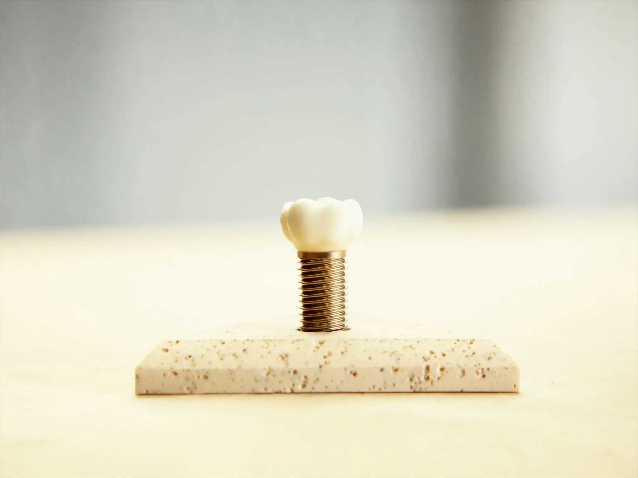Modelo de implante dental